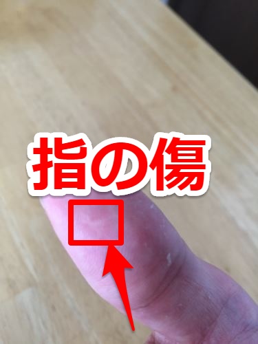 指の傷